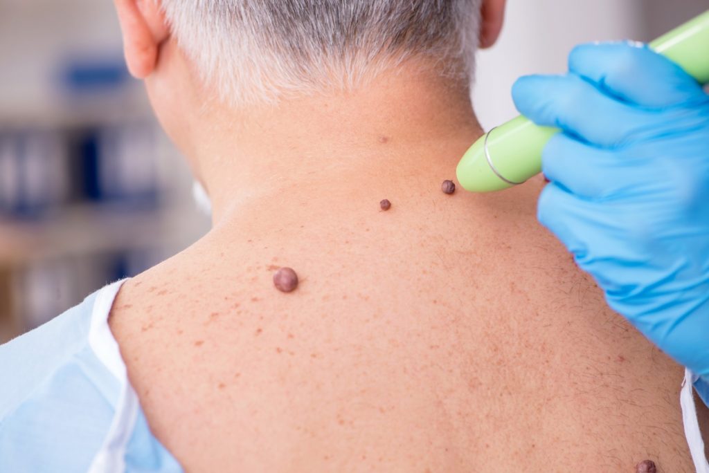 immunotherapy in israel