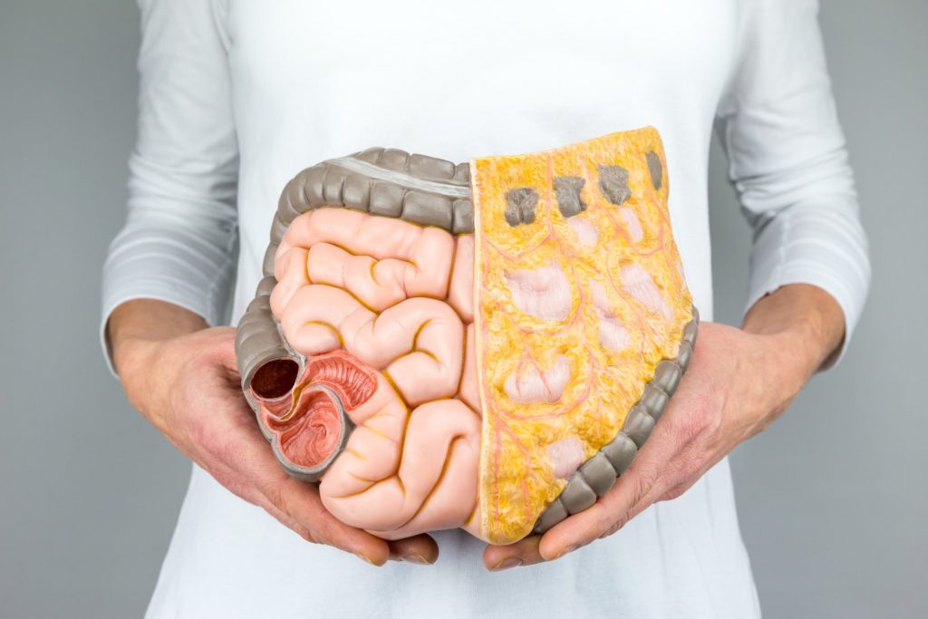 colon cancer treatment in israel