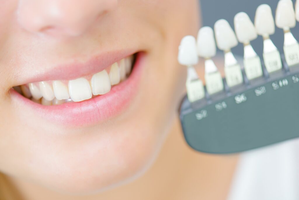 dental implants abroad
